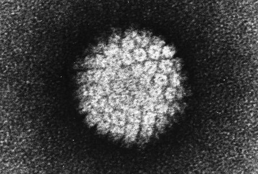 Májusban kezdődik a HPV védőoltási program Csepelen | kép forrása: wikimedia.org