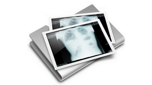 Új röntgengépet kap a XVI. kerület Kertvárosi Egészségügyi Szolgálat