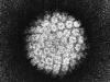 Májusban kezdődik a HPV védőoltási program Csepelen | kép forrása: wikimedia.org